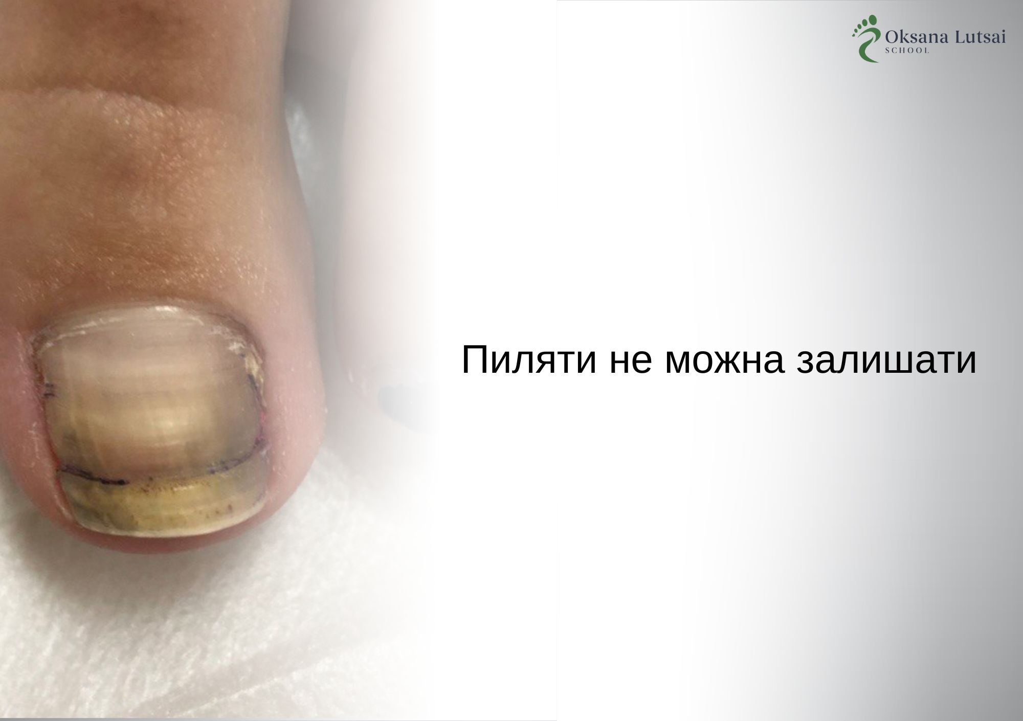Пиляти не можна залишати