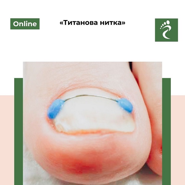 Онлайн курс «Титанова нитка»