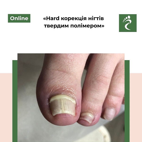 Онлайн курс «Hard корекція нігтів твердим полімером»